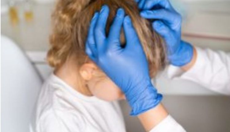 About Lice Removal Boca