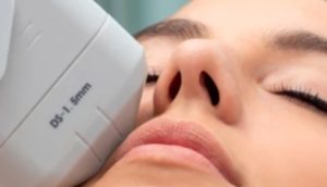 The Rising Popularity of Ultherapy HK: The Preferred Choice for Skin Lifting and Tightening