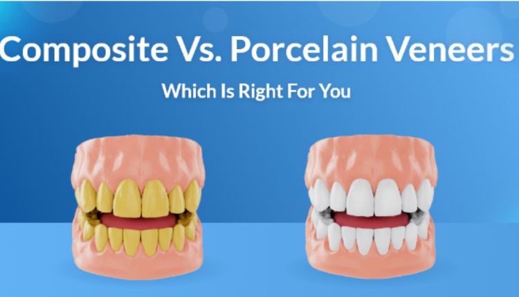 Porcelain Veneers